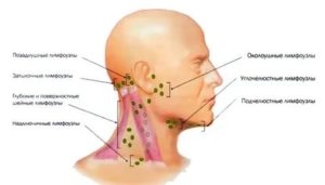 Увеличены шейные, затылочные и подчелюстные лимфоузлы