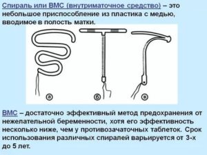 Какую спираль выбрать