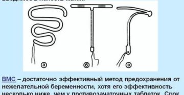 Какую спираль выбрать Какую спираль выбрать