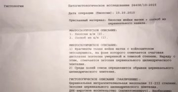 Расшифровка биопсии шейки матки, дисплазия 3 степени Расшифровка биопсии шейки матки, дисплазия 3 степени