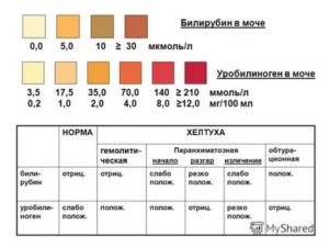 Уробилиноген в моче ребенка