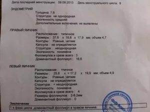 На 15 день цикла фолликул 25 мм, эндометрий 8!
