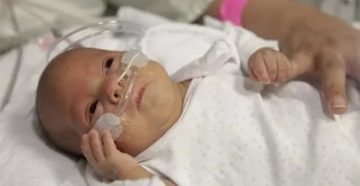 Маленький плод Маленький плод