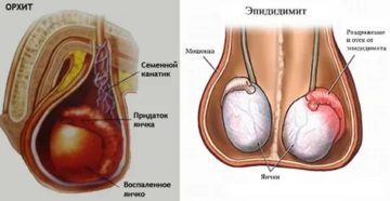 Мягкий член, мало наполнены яички