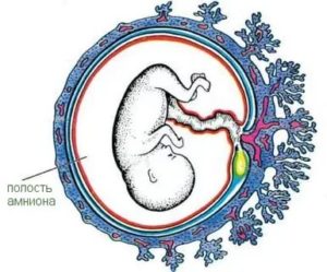 Амнионит при беременности