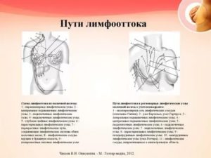 УЗ-признаки изменений л/узлов подмышечной области