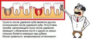 Анализы крови после удаления зуба мудрости