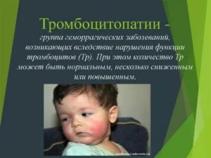 Тромбоцитопатия у ребенка
