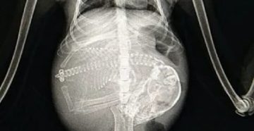 Рентген при беременности