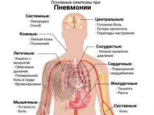 Рвота при пневмонии