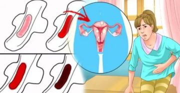 Не идут месячные что делать Не идут месячные что делать