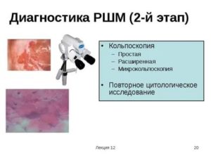 Цитология, кольпоскопия