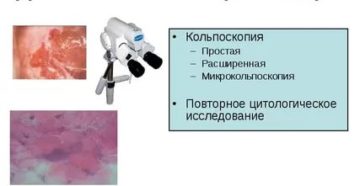 Цитология, кольпоскопия Цитология, кольпоскопия