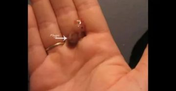 Беременность 4-5 недель, угроза выкидыша на раннем сроке