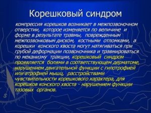 Корешковый синдром