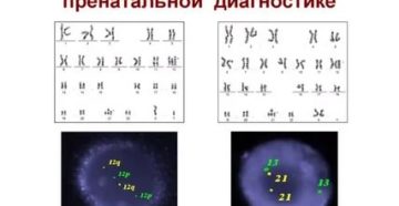 Расшифровка цитогенетического исследования Расшифровка цитогенетического исследования