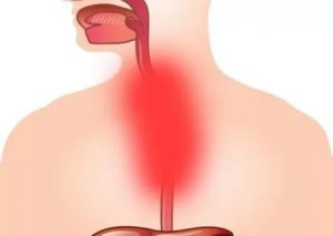Жжет пищевод после рвоты