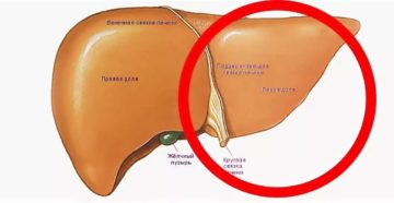 Увеличена левая доля печени